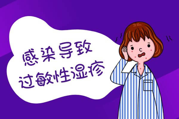 引起过敏性湿疹的原因 第3张