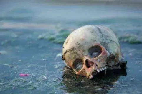 尸斑出现在死亡后几小时（人死之后身体会发生哪些变化） 第23张